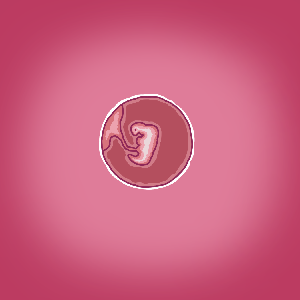 Yumi's Study Abroad/由美的留学生活（汉化）（连载中） - Page 16